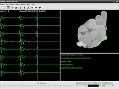 Dynamic mapping of atrium record