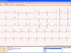 ECG