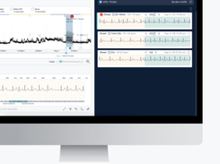 Cardiologs Screenshot 2