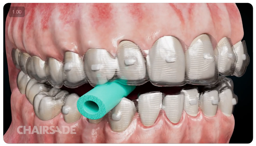 Chairsyde Screenshot 1