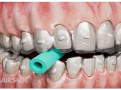 Chairsyde Screenshot 1