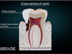 Chairsyde Screenshot 1