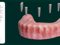 Chairsyde Screenshot 1