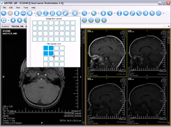 Easily set image layout