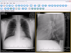 Magnifying lens to explore anatomy