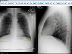 Review x-ray images