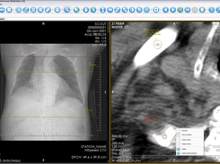Review computed tomography images