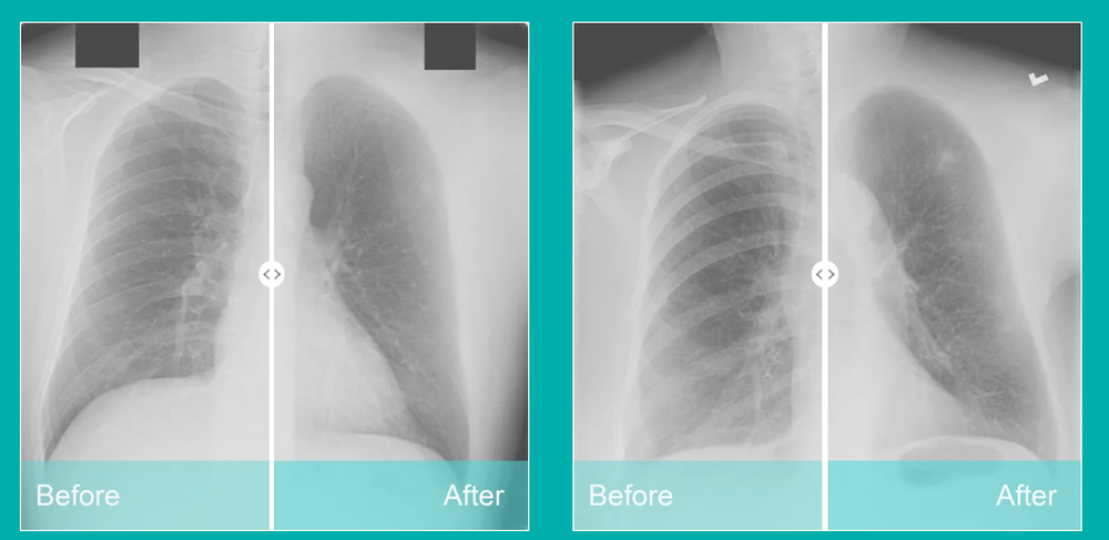 ClearRead Xray Screenshot 1