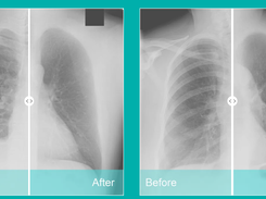 ClearRead Xray Screenshot 1