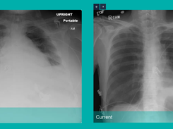 ClearRead Xray Screenshot 1