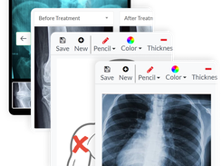 Clinicea Imaging lets you annotate, take pictures, and more, on the cloud.