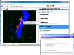 User defined cell interaction analysis of a fluorescent bone image with in-program scripting.