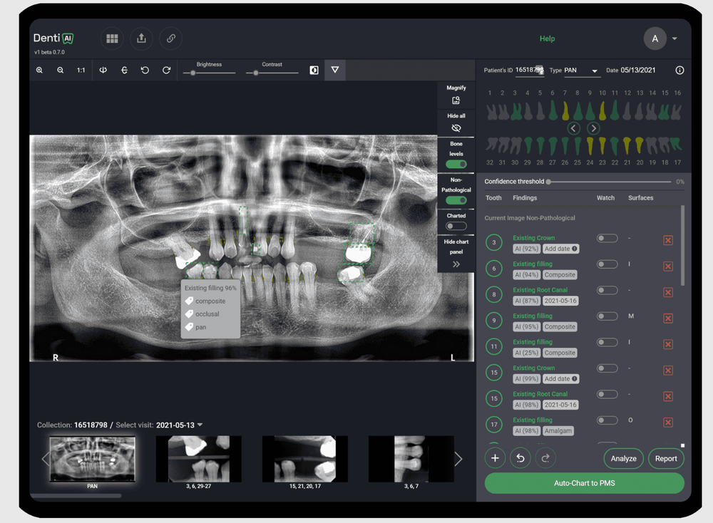 Denti.AI Screenshot 1