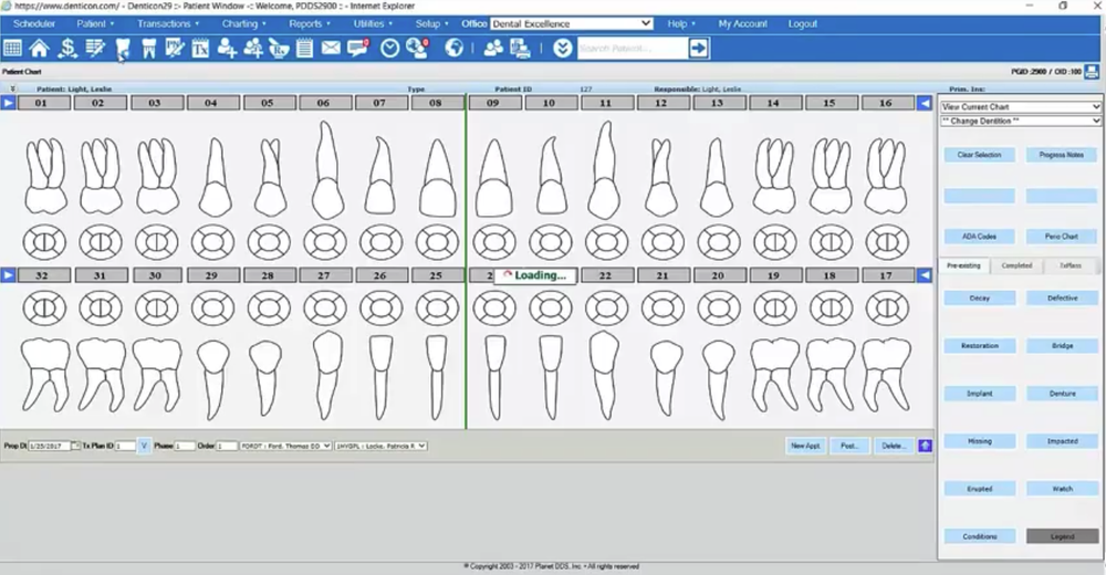 Denticon-Chart