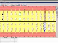 DentrixEnterprise-DentalChart