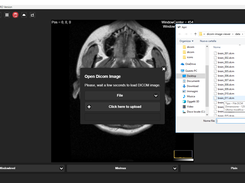 Open single dcm file