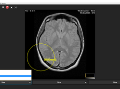 DICOM Image Reader Screenshot 4