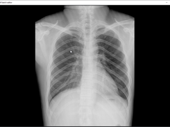 View DICOM pixel data