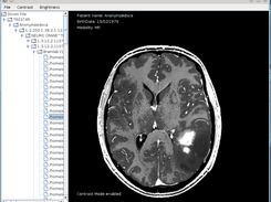 Adjusting contrast by mouse dragging
