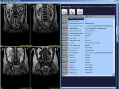 Show DICOM Tags