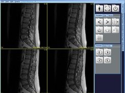 A MRI Study