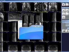 Dicom Open Viewer