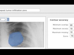 Image-based quizzes : hotspots, delineation...