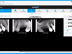 Dovetail-Xray