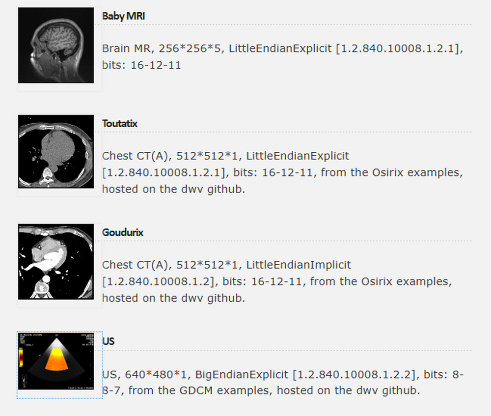 DWV (DICOM Web Viewer) Screenshot 1
