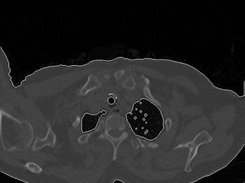 Using EasyBMP for medical image segmentation