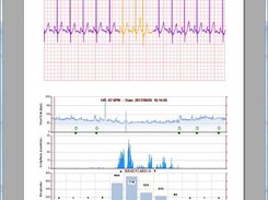 ECG Logger Viewer: prints