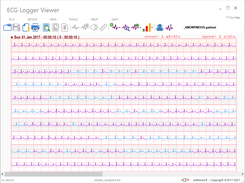 ECG Logger Viewer: browser