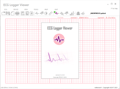 ECG Logger Viewer: Application