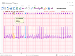 ECG Logger Viewer: Edit
