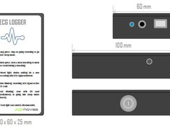 ECG Logger: Holter casing