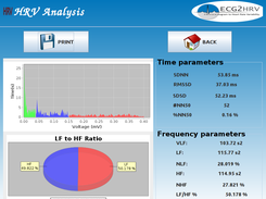 HRV analysis