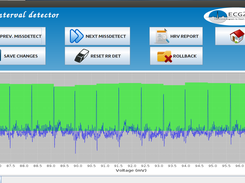RR detection / Edition