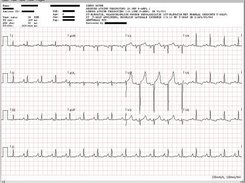 The ECG Viewer included in the Toolkit