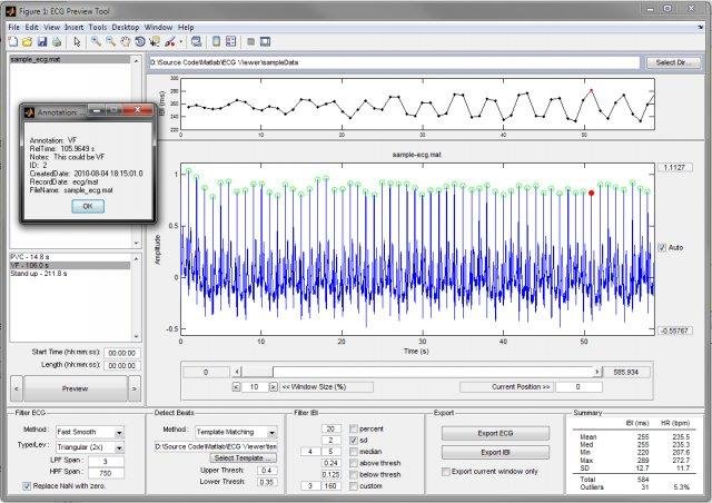 Ecg Software Download For Pc Ecg Software Download For Pc