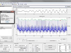 ECG Viewer Screenshot 1