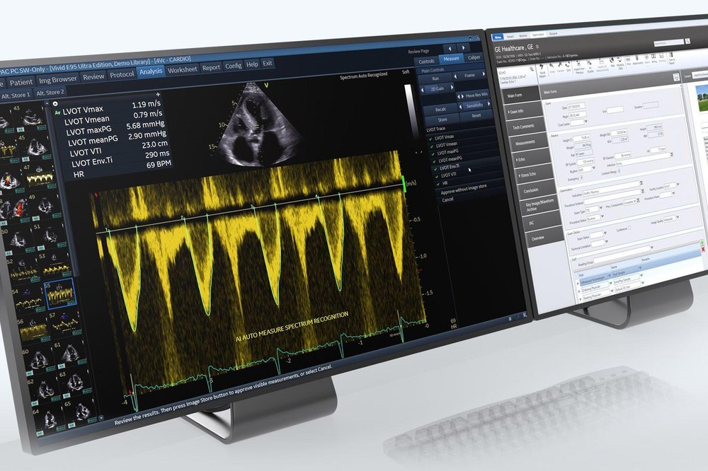 EchoPAC Screenshot 1