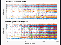 EEG Seizure Prediction Screenshot 1