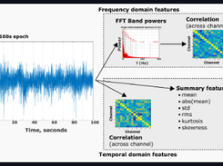 EEG Seizure Prediction Screenshot 2