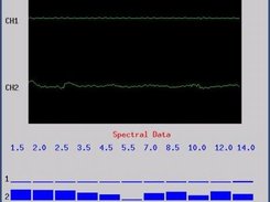 Basic EEG Monitor (Basic Kit)