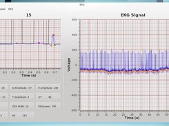 Foad (EKG Processing) Screenshot 4