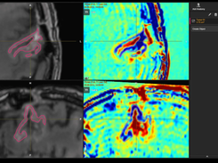 Elements Contrast Clearance Analysis Screenshot 1