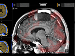 Elements Cranial SRS Screenshot 1