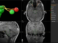 Elements Cranial SRS Screenshot 1