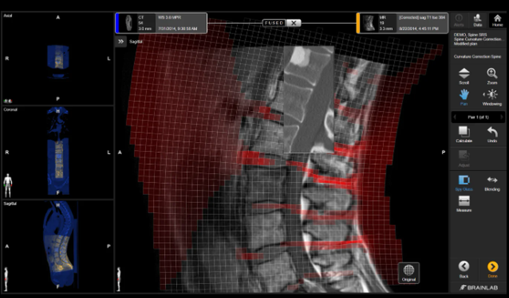 Elements Spine SRS Screenshot 1