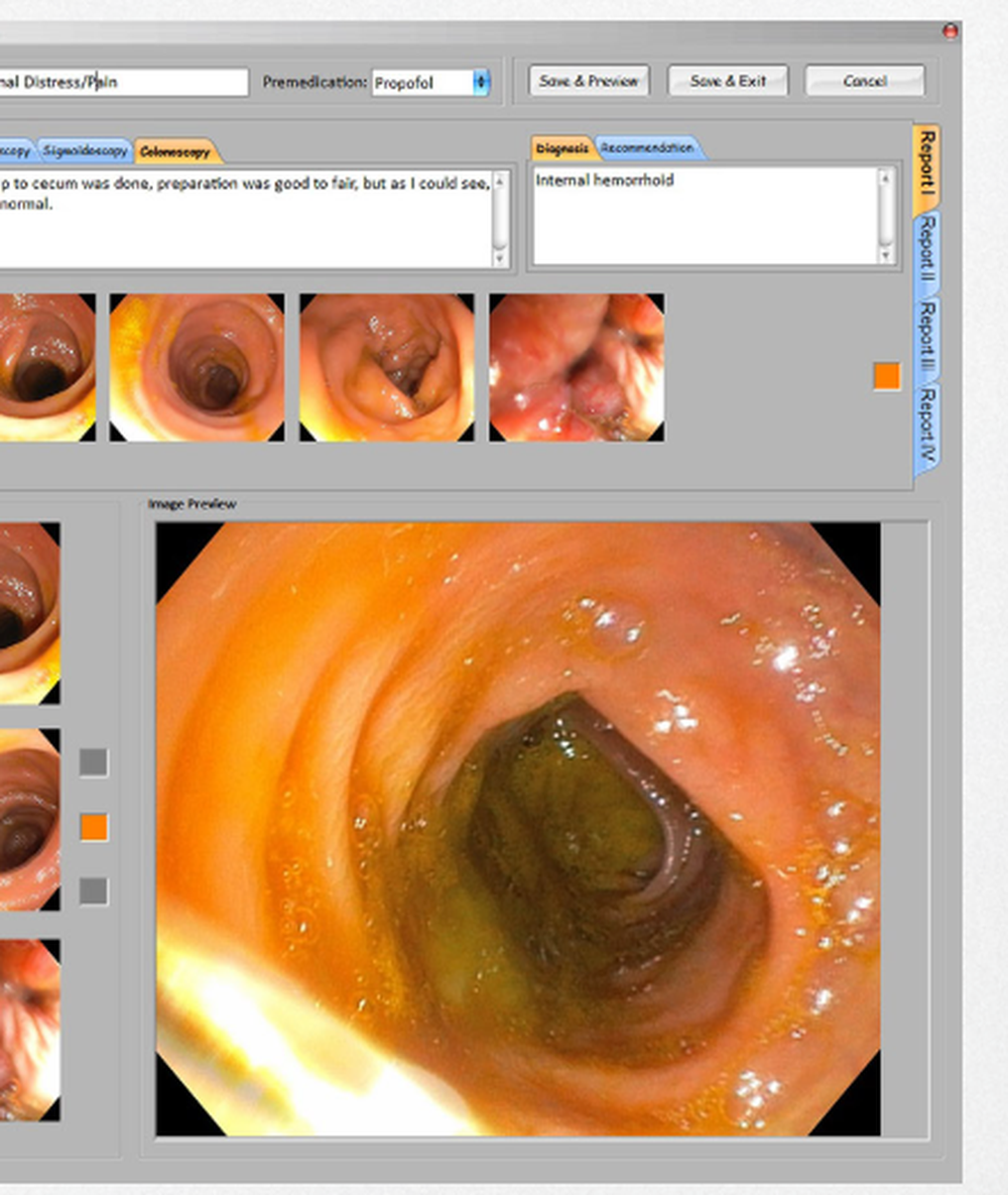 EndoPACS Screenshot 1
